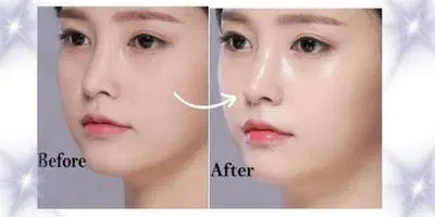 Korean Glass Skin Glow Serum, 30 Ml